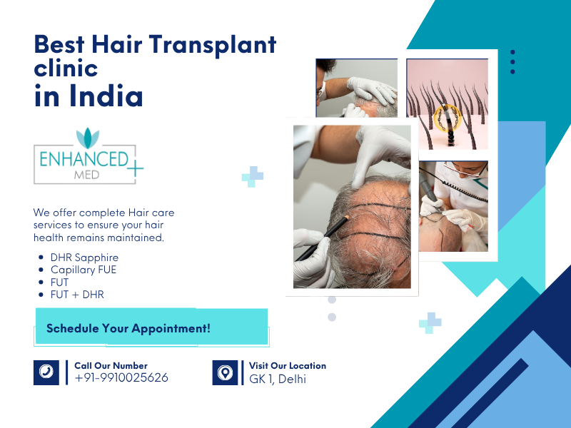 Best Hair Specialist in Delhi Your Guide to Affordable Hair Transplant Surgery