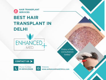 Hair Restoration A Guide from Big Foreheads to Medical Causes
