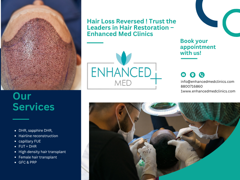 Understanding and Managing Female Hair Loss Causes and Treatments